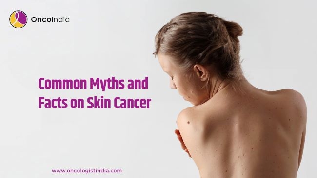 Common Myths and Facts on Skin Cancer at Dr. Shiva Kumar Uppala