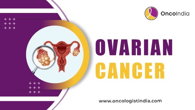 Ovarian Cancer Treatment at Dr. Shiva Kumar Uppala