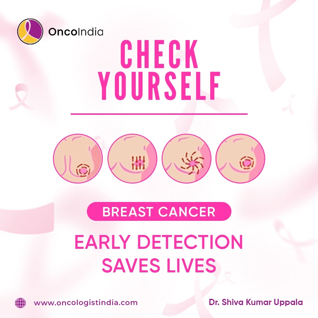 How to Check for Breast Cancer A Complete Guide