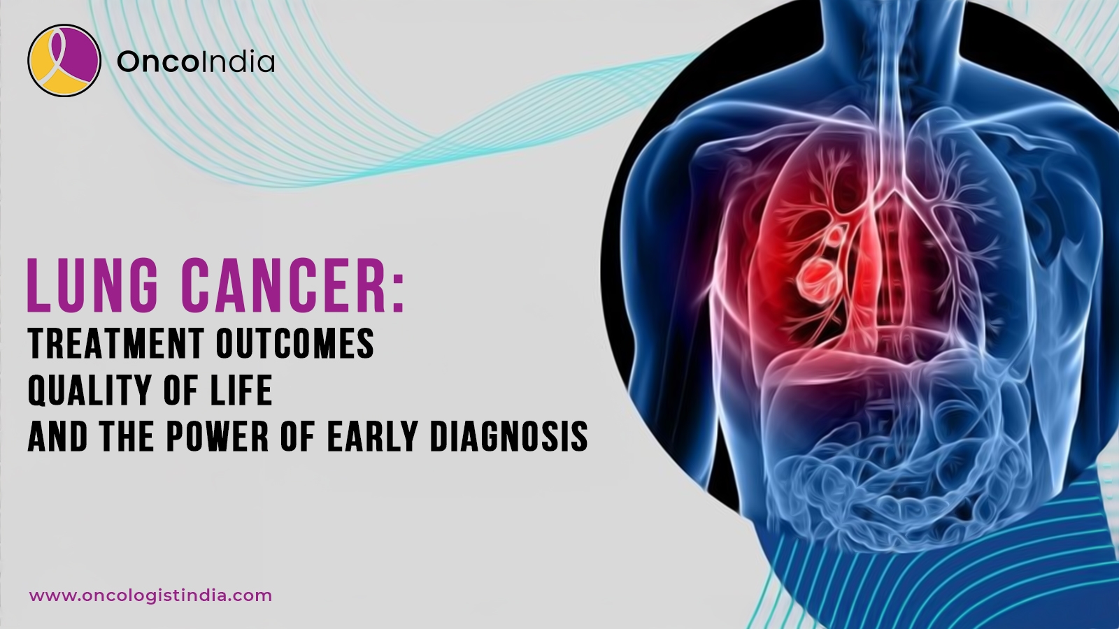 Lung Cancer: Treatment Outcomes, Quality of Life, and the Power of Early Diagnosis