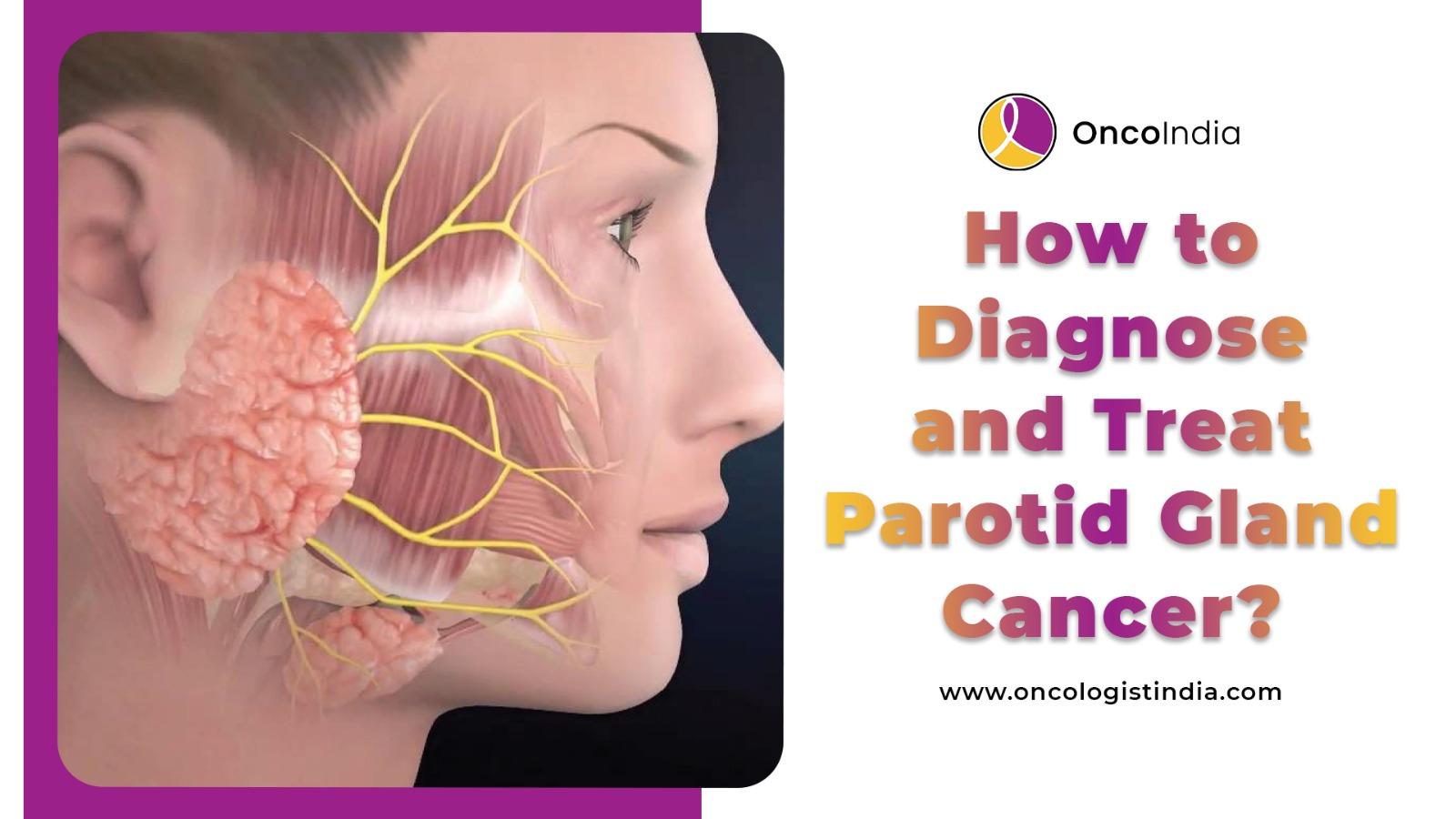 How to Diagnose and Treat parotid gland cancer?